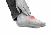 How Is Gout Diagnosed?