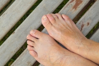 What Can Be Done for Hammertoes?